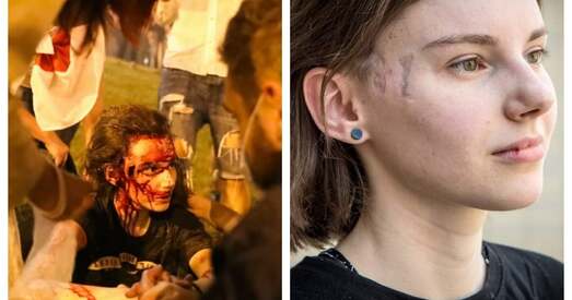 Ахвяра сілавікоў Марыя Зайцава: За свабоду я заплаціла сваім здароўем