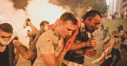 «Я калі апрытомнеў, то дактары дзівіліся. Казалі — глядзі ж ты, выжыў»