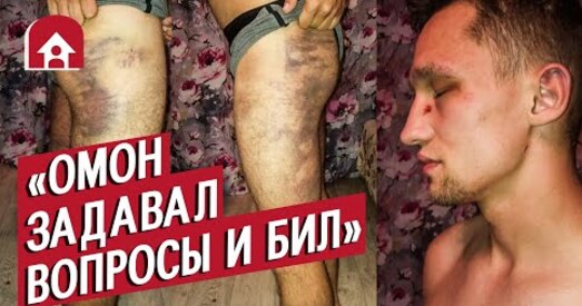 «На спіне малявалі крыж з надмагіллем». Гісторыя затрыманага фельчара