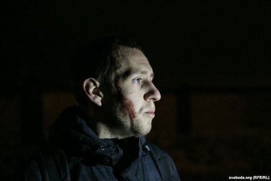 Паранены абаронца месца новай будоўлі каля Курапат Алесь Кіркевіч / svaboda.org Паранены абаронца месца новай будоўлі каля Курапат Алесь Кіркевіч / svaboda.org