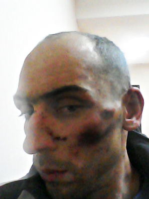 mishakouski_paslia_zbiccia_milicyjaj_2_logo.jpg mishakouski_paslia_zbiccia_milicyjaj_2_logo.jpg