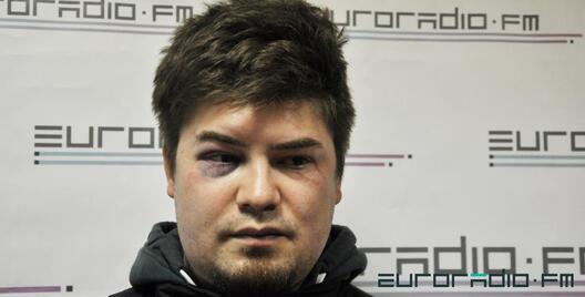 Алег Ларычаў праз дзень пасла збіцця. Фота: Еўрарадыё Алег Ларычаў праз дзень пасла збіцця. Фота: Еўрарадыё