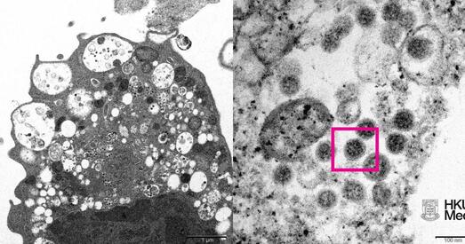 Стала вядома, як выглядае каронавірусны штам «Амікрон»