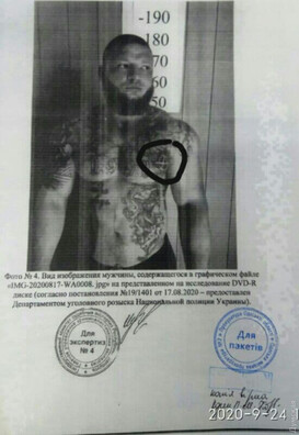 З матэрыялаў суда. Беларускія ўлады ставяць у віну Зайцаву татуіроўку з выявай сімвала анархіі. Фота: dumskaya.net З матэрыялаў суда. Беларускія ўлады ставяць у віну Зайцаву татуіроўку з выявай сімвала анархіі. Фота: dumskaya.net