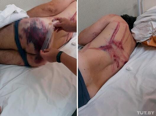 Так выглядаў Аляксандр пасля затрымання. Фота прадастаўлена чытачом Так выглядаў Аляксандр пасля затрымання. Фота прадастаўлена чытачом