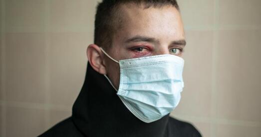 Ударылі кулаком у вока, рассеклі галаву. Траўмы пасля жорсткіх затрыманняў 11 кастрычніка